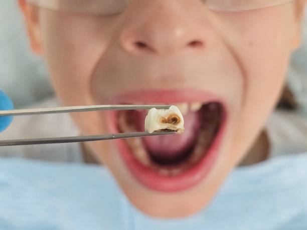 Best Emergency Pediatric Dental Care in USA
